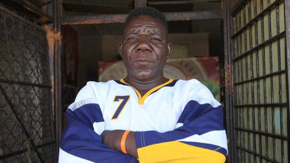 alt="Nyakim Gatwech, known as the blackest person in the world, posing for a photoshoot"